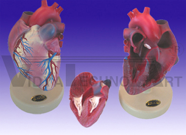 Normal heart in light atheroscierosis